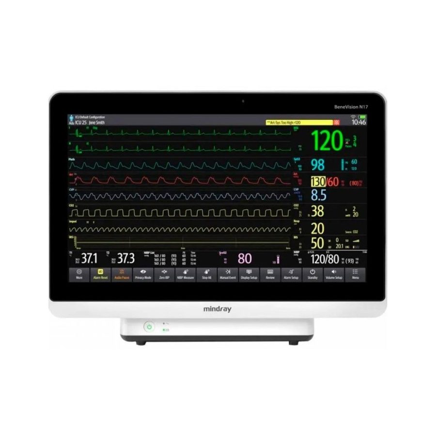 Mindray BeneVision N15